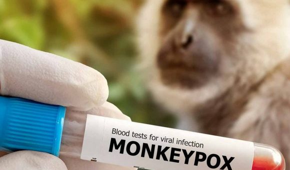Declara OMS emergencia sanitaria internacional por viruela del mono